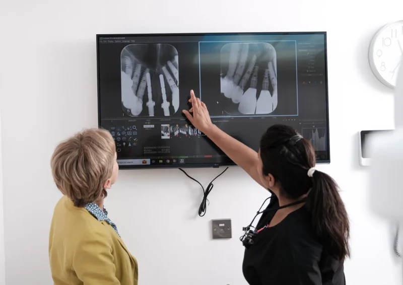 Ip-Implant-Thumb-2048x1365